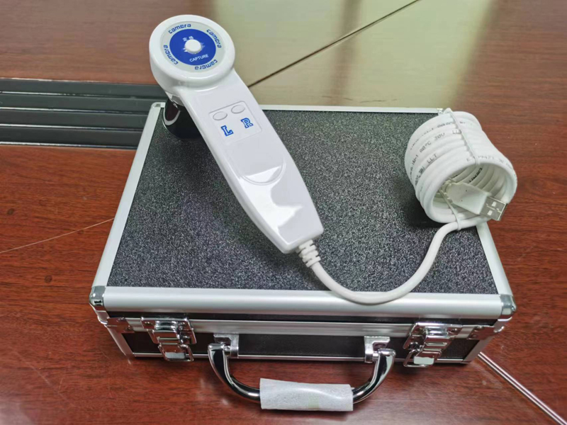 Cámara Digital de Iridología d - Qh Furniture reseña y precio